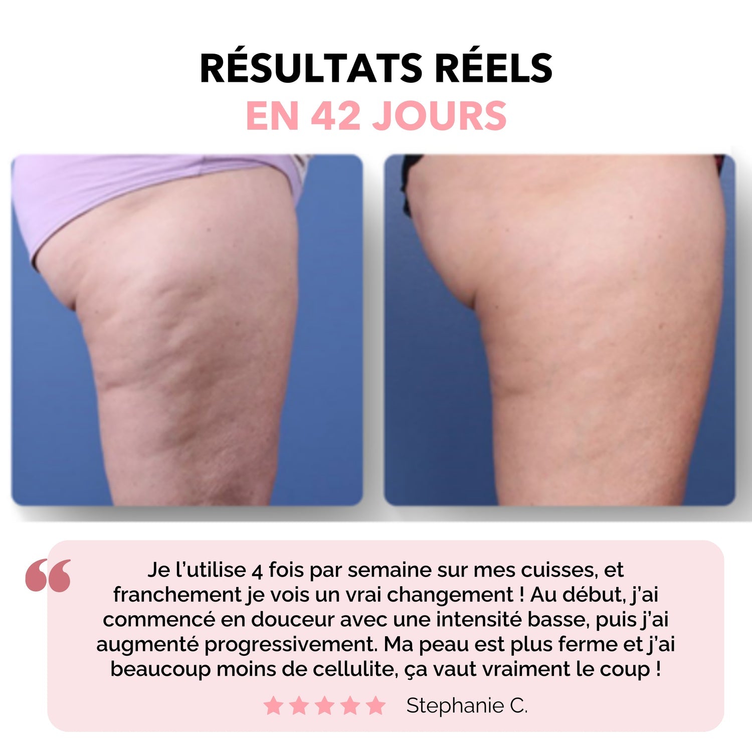 Beprime™ - Masseur AntiCellulite